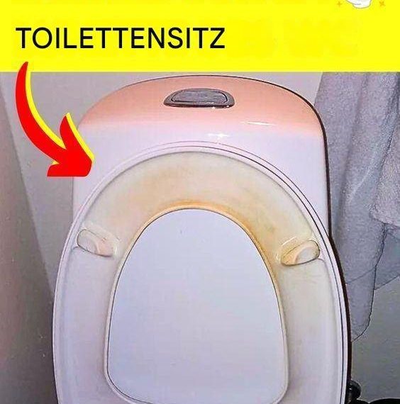 Der Trick, um gelbe Flecken auf dem WC-Sitz zu entfernen