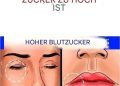 12 Anzeichen dafür, dass Ihr Zuckerhaushalt im Körper aus dem Gleichgewicht ist