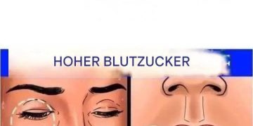 12 Anzeichen dafür, dass Ihr Zuckerhaushalt im Körper aus dem Gleichgewicht ist