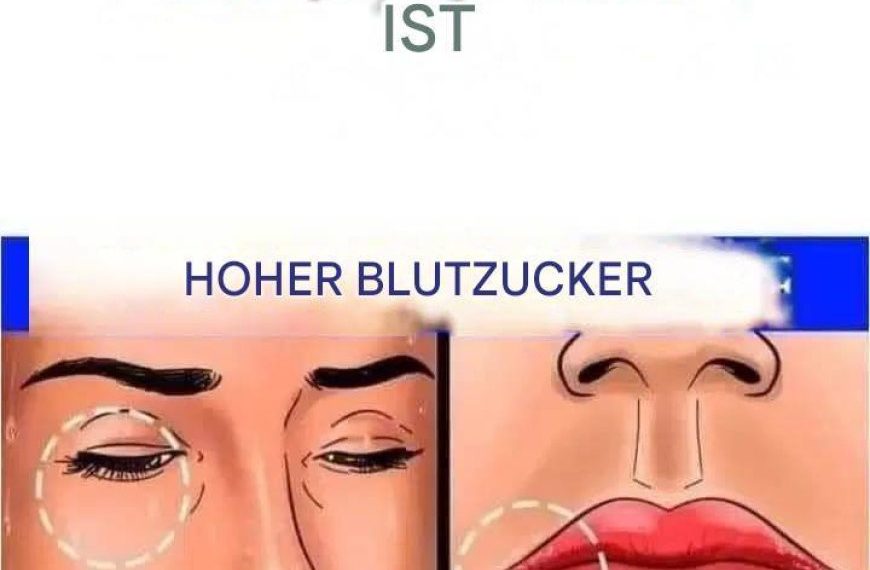 12 Anzeichen dafür, dass Ihr Zuckerhaushalt im Körper aus dem Gleichgewicht ist