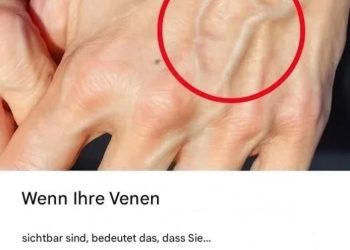 Wenn Sie sichtbare Venen haben, bedeutet das, dass Sie