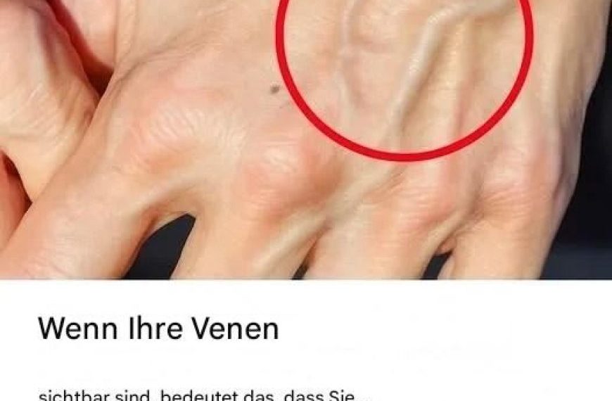Wenn Sie sichtbare Venen haben, bedeutet das, dass Sie