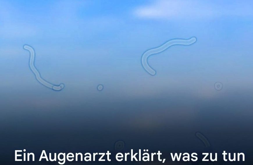 Was sind Mouches volantes? Das sollten Sie tun, wenn Sie sie sehen