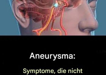 Aneurysma: Symptome, die Sie nicht ignorieren sollten