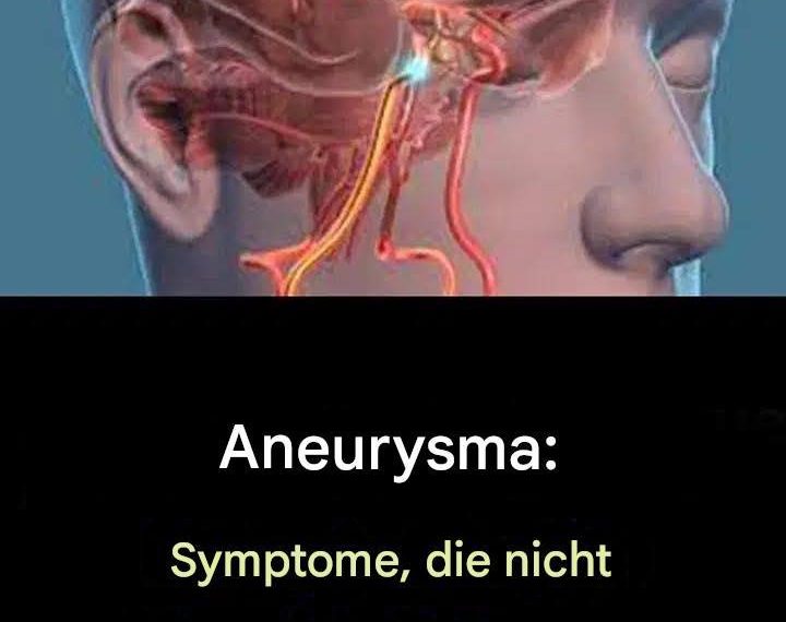 Aneurysma: Symptome, die Sie nicht ignorieren sollten