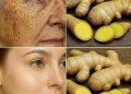 Eine natürliche Alternative zu Botox zur Faltenreduzierung