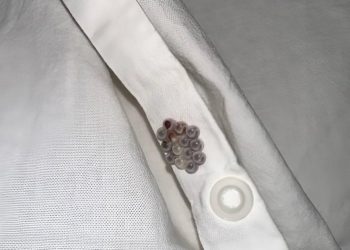 Ich habe diese kleinen Murmeln in meinem Bett gefunden und hätte fast einen Herzinfarkt bekommen: Ich verrate Ihnen, was es war.